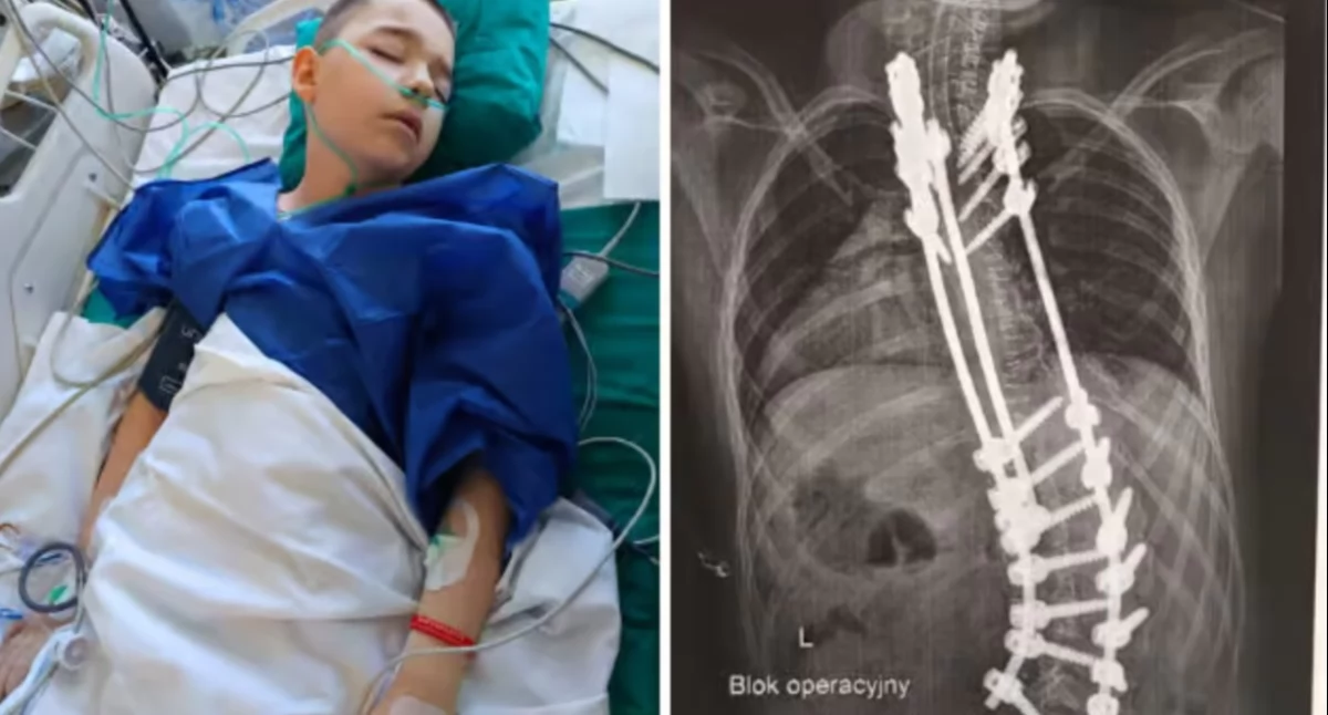 Pomoc potrzebna, Wojtek Karwasz kolejnej operacji Konieczna będzie rehabilitacja - zdjęcie, fotografia